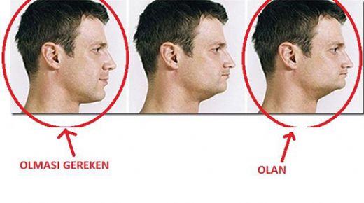 Çene Kemiği Erimesi Belirtileri ve Tedavisi