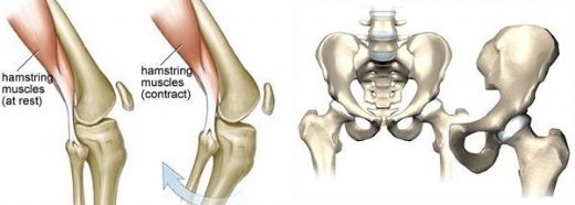 Femur Kemiği Kırığı Ameliyatı Riskleri ve Sonrası