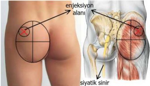 Kalça Kemiği Görevleri Nelerdir?