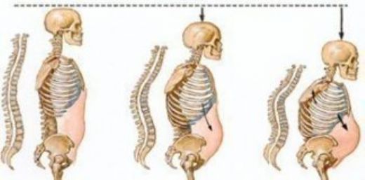 Kemik Çürümesi Belirtileri ve Tedavisi