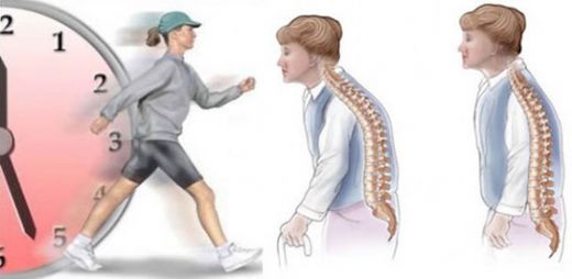 Kuyruk Sokumu Kemiği Ağrısı Belirtileri ve Tedavisi