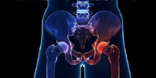 Leğen Kemiği Kanseri Belirtileri ve Tedavisi