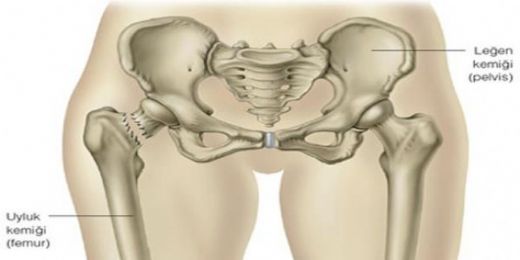 Sol Kalça Kemiği Ağrısı Belirtileri ve Tedavisi